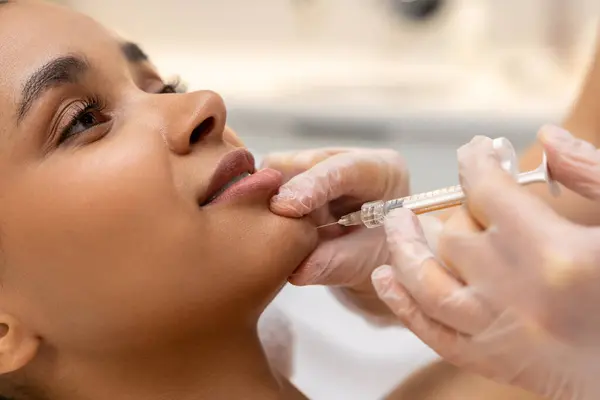 Lipverzorging Donkere Vrouw Die Hyaluronzuur Lippen Injecteert — Stockfoto