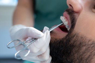 Diş bakımı için dişleri denetlemek ve klinikte bakım sağlamak için profesyonel aletler kullanan ortodonti uzmanı.