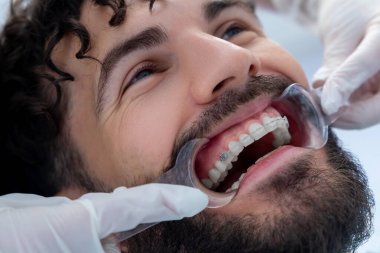 Tedavi sırasında dişçi muayenehanesinde dişçi aletleriyle sakallı hasta.