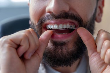 Sakallı adam dişlerini ve diş tellerini dikkatlice temizliyor. Diş sağlığı ve kişisel bakımını garanti altına alıyor.