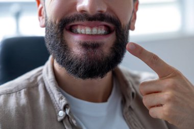 Dişlerinin düzgün bir şekilde hizalandığından emin olmak için dişlerini diş telleriyle gösteren neşeli bir adam.