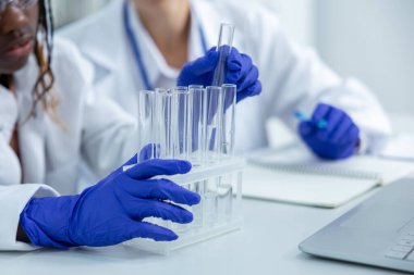 Laboratuvarda elinde pipetler bulunan tanınmayan tıp kadınları klinikteki aşı geliştirme aşıları üzerinde virüs örnekleri üzerinde test yapıyorlar.
