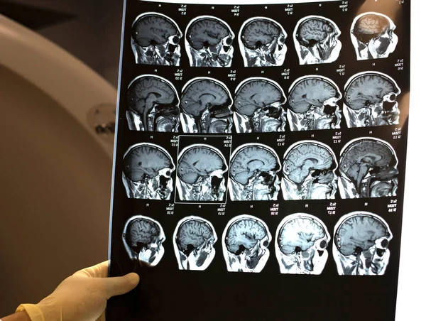 MRI scan of the brain. The doctor looks at the picture in the office. Magnetic resonance scan of the brain.