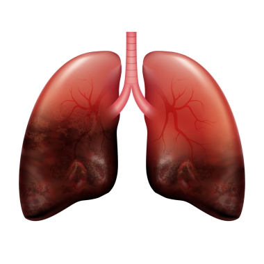 Üç boyutlu gerçekçi, yarı çürümüş, sağlıksız insan organı akciğeri.