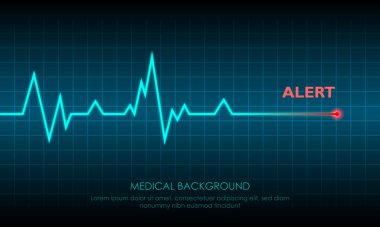 Illustration of Emergency ekg monitoring. Blue Glowing Neon Heart Pulse. Heartbeat. Dark Blue Background with a Grid. Vector Illustration. All in a single layer.