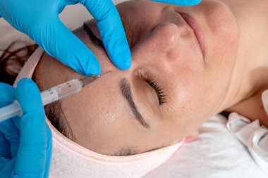 Güzellik uzmanı müşterinin alnına hyaluronik asit enjekte ederek yüzündeki kırışıklıkları kapatıyor. Orta yaşlı kadın bir güzellik salonunda kırışıklık önleyici hiyalüronik dolgular alıyor..