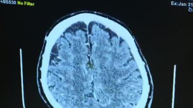 İnsan beyninin detaylı MR taraması kritik yapıları ve karmaşık vasküler kalıpları vurguluyor.