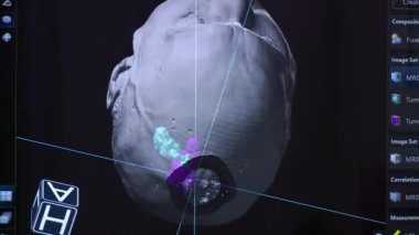 Detaylı tıbbi analiz için gelişmiş üç boyutlu görüntüleme teknolojisi kullanılarak yaratılan kafatasının görsel bir temsili.