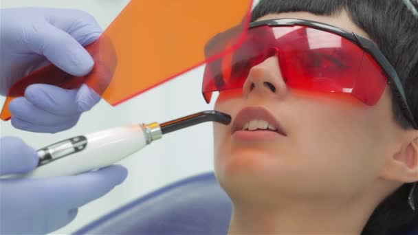 Zahnarzt Leuchtet Ultraviolette Photopolymer Dichtung Auf Die Fixierung Seitenansicht Zahnarzt — Stockvideo