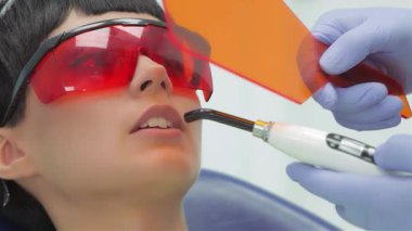 Koruyucu gözlük takan yetenekli bir dişçi, hastaların dişlerine morötesi bir mühür takarak en iyi diş bakımını sağlar. Parlak, klinik ortam tedavinin hassasiyetini vurguluyor.
