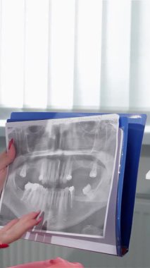 Kendini işine adamış beyaz kadın bir dişçi, el değmemiş bir sağlık üniforması içinde, özenli sarışın hastasıyla uğraşırken bir roentgenogramda diş ile ilgili endişelere ustaca işaret ediyor. Gelişmiş aletlerle dolu, parlak, modern dişçi ofisi.