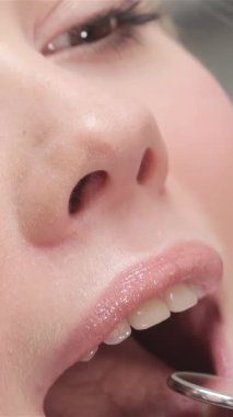 Bu samimi yakın planda, bir dişçi hastaların ağzını kontrol etmek için dişçi aynasını ustalıkla kullanır, sakin ve güven verici bir ortam yaratır. Neşeli genç kadın, parlak sarı saçları ve parlak gülüşüyle, güven ve rahatlık saçar.