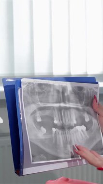 Kendini işine adamış beyaz kadın bir dişçi, el değmemiş bir sağlık üniforması içinde, detaylı bir roentgenogram kullanarak özenli sarışın hastasına diş sorunlarını tutkuyla açıklıyor. Parlak, modern diş muayenehanesi, son model aletlerle süslenmiş ve...