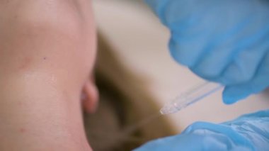 cosmetic procedure gas-liquid peeling - rejuvenation and regeneration of the skin using a jet consisting of oxygen and liquid. The cosmetologist holds an applicator with oxygen and carbon dioxide in