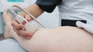 The doctor does an ultrasound of the veins on the patients legs. A phlebologist checks the veins on a womans legs with an ultrasound machine in a modern clinic.