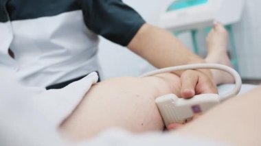 The doctor does an ultrasound of the veins on the patients legs. A phlebologist checks the veins on a womans legs with an ultrasound machine in a modern clinic.