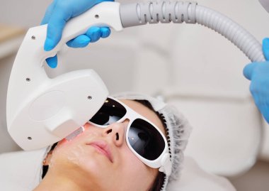 hardware procedure photo rejuvenation - treatment of rosacea, acne, pigmentation. The cosmetologist restores the patients skin with the help of hardware RF -fractional rejuvenation