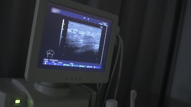Närbild Monitorn Resultatet Ultraljudsundersökning Bröstet Förebyggande Bröstcancer — Stockvideo