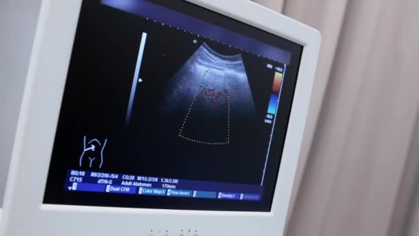 Detailní Ultrazvuk Dutiny Břišní Monitoru Moderní Klinice — Stock video