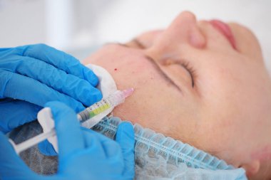 A cosmetologist makes a mesotherapy or plasmolifting procedure for the patient. Biorevitalization is a method of skin regeneration by microinjections of hyaluronic acid.