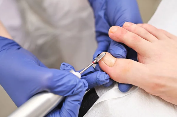 Hardware Medical Pedicure Drill Nail Files Patient Pedicure Podiatrist Hardware — Fotografia de Stock