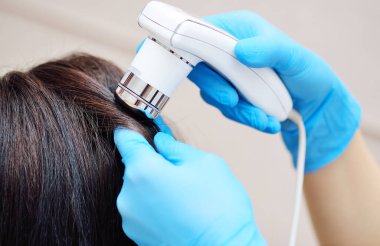 doctor cosmetologist dermatologist diagnoses the condition of the patients hair using a trichoscope. Trichoscopy - computer examination of the scalp and hair