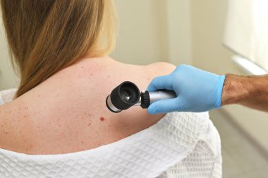 Bir dermatolog onkolojist hastaların vücutlarındaki benleri ve doğum lekelerini incelemek için dermatoskop kullanır. Melanoma Günü, Cilt Kanseri