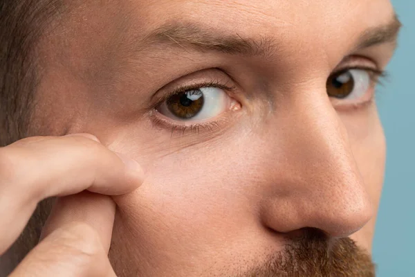 Konzentrierter Mann Hat Anzeichen Alternder Haut Gesicht Konzentrierte Mann Mittleren — Stockfoto