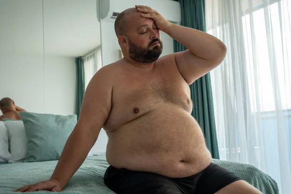 Depressiv Överviktig Man Känner Sig Överarbetad Kropp Grund Metabolisk Störning — Stockfoto