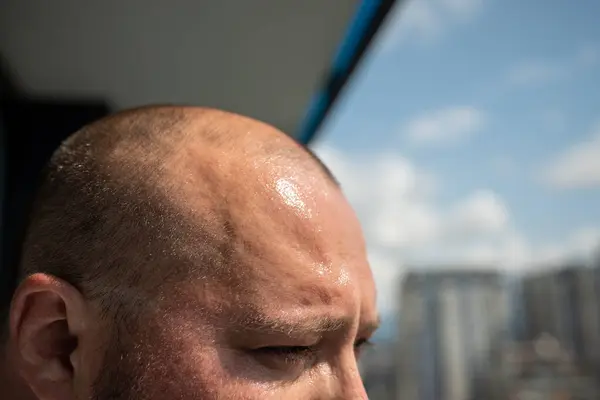 stock image Sweat broke out on forehead of overweight man in hot weather standing in sun. Guy is sweating from heat, squinting looking at street from balcony. Stuffiness, unbearable summer swelter concept.