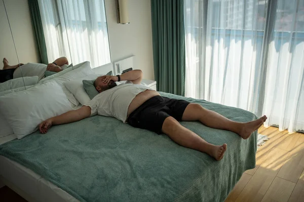 Şişman Adam Sıcaktan Ölüyor Tembel Obez Aşırı Kilolu Genç Adam — Stok fotoğraf