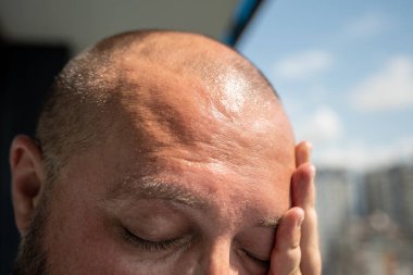 Man forehead, sunstroke, sweat on face, bald head. Close up. Guy suffers from heat, high temperature and humidity, pressure, being in hot scorching summer sun at balcony, overheating superheating clipart