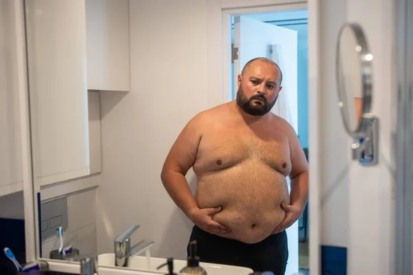肥胖的家伙摸着镜子前面的胃 年轻的留着胡子的秃头男人 过度肥胖的样子对着镜子 对肥胖 体形感到不满 — 图库照片