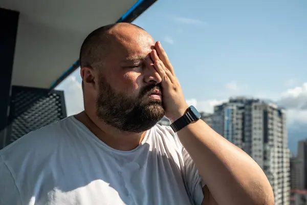 stock image Fat man suffers dying from heat. Obese overweight guy on balcony under hot bright scorching summer sun sweats from warmth, not tolerate high temperatures, putting hand to overheated face head