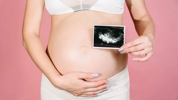 Happy Expectant Mother Shows Ultrasound Image Fetus Camera Prenatal Ultrasound — Foto de Stock