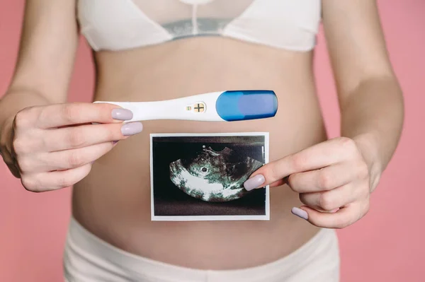 Una Madre Embarazada Feliz Muestra Una Imagen Ultrasonido Del Feto —  Fotos de Stock