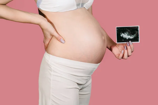 幸せな妊婦は カメラに胎児の超音波画像を示しています 出生前超音波検査 生まれていない子供のソノグラムを持っている若い妊婦の腹部のクローズアップ — ストック写真