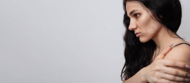 Cilt sorunu olan genç bir kızın yakın çekimi. Sivilceler, sivilceler, gözenekler, yaralar. Filtreli ya da filtresiz doğal deri. Metnin için bir yer