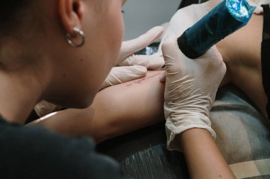 Bir bayan müşteri rahat bir yatakta yatıyor ve bir dövme sanatçısı koluna dövme yaptırıyor.