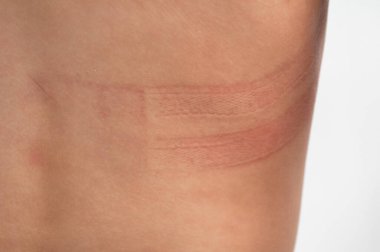 Sırtında sütyen izleri var. Kız iç çamaşırıyla sırtını ovdu. Rahatsız edici sutyen. Yanlış beden iç çamaşırı. Cesedin üzerinde giysi izleri var.