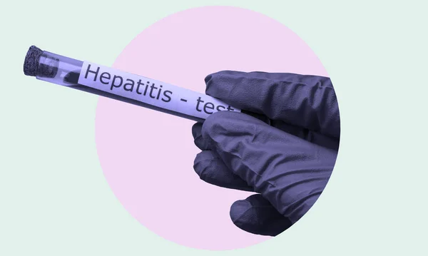 Konstkollage Hand Medicinsk Handske Som Håller Ett Blodprovsrör Mot Hepatit — Stockfoto