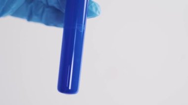 medical test tube in the hands of a laboratory assistant, research, and analysis
