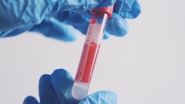 Test Tube Blood Test Hands Laboratory Assistant Blood Test — Video Stock