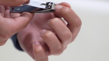 A guy cuts nails on fingers on his hand with pliers on a white background