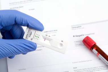 Ekspres korona testi. Negatif covid antijen testi.