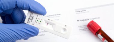 Ekspres korona testi. Negatif covid antijen testi.