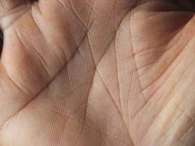 Avuç içinde avuç içi çizgisi kesişiyor. Avuç içi çizgisini kapat. 