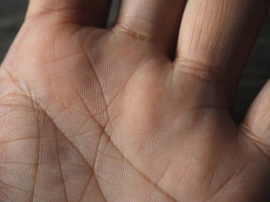 Avuç içinde avuç içi çizgisi kesişiyor. Avuç içi çizgisini kapat. 