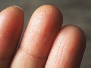 Avuç içinde avuç içi çizgisi kesişiyor. Avuç içi çizgisini kapat. 