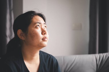 İnsanlar ve umut kavramı. Yüze yakın kadın, umut ve inanç hissederek yukarı bakıyor. Dua eden kadın. Hıristiyanlık inancı, uluslararası ibadet günü, düşüncelerde kaybolmuş bir kadın bunalımda.